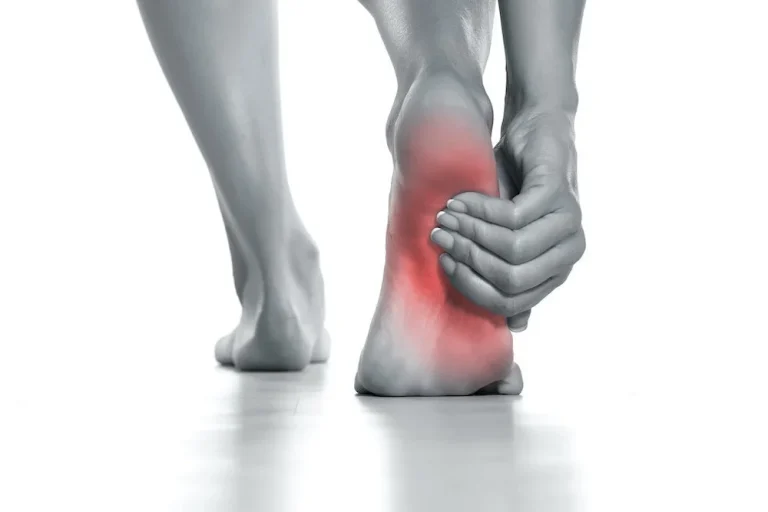 plantar fasciitis specialist evaluations 